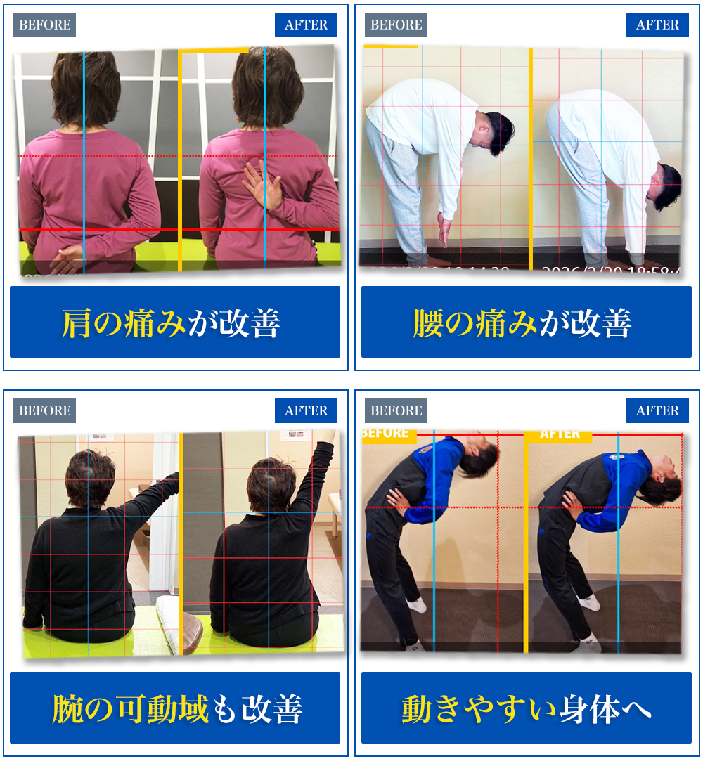 肩・腰・腕の可動域・動きやすさが改善したBefore After比較写真