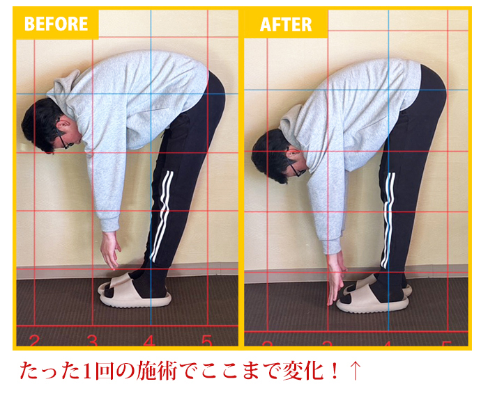 10代男性 T・K様 手技施術でスポーツ外傷が短期改善