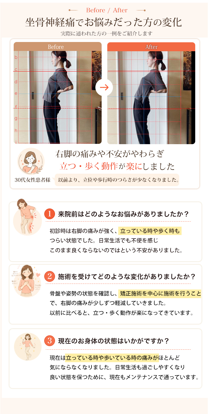 坐骨神経痛でお悩みだった方のBefore/After