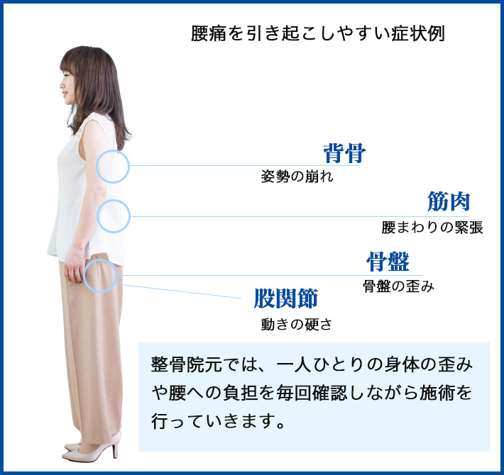 腰痛を引き起こしやすい部位の図解